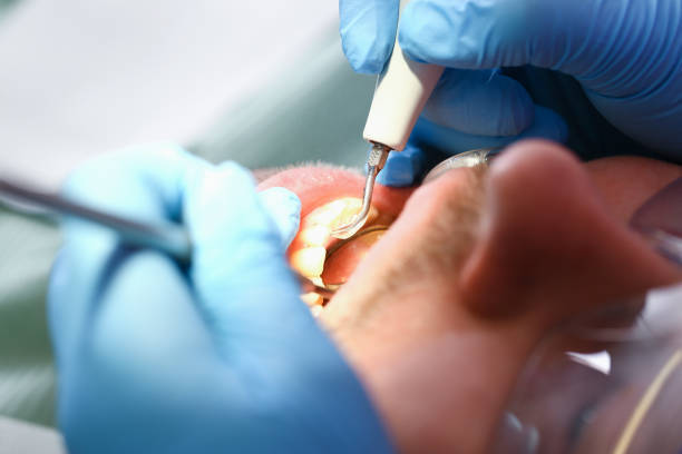 Best Emergency Dental Services for Seniors in Powell, OH