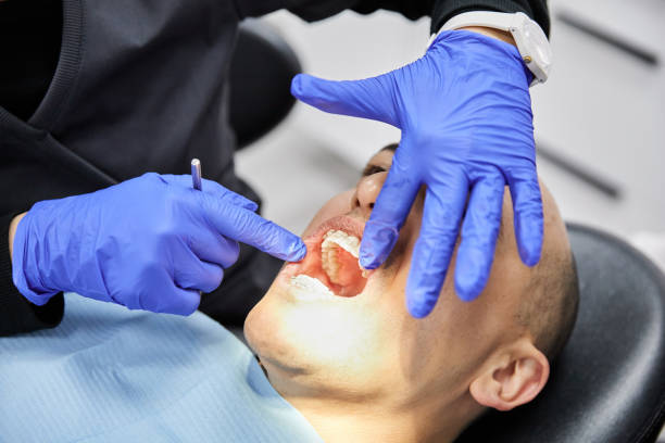 Best Emergency Dentist for Lost Fillings or Crowns in Powell, OH